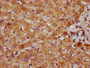 IHC image diluted at 1:300 and staining in paraffin-embedded human liver tissue performed on a Leica BondTM system. After dewaxing and hydration, antigen retrieval was mediated by high pressure in a citrate buffer (pH 6.0). Section was blocked with 10% normal goat serum 30min at RT. Then primary antibody (1% BSA) was incubated at 4°C overnight. The primary is detected by a biotinylated secondary antibody and visualized using an HRP conjugated SP system.