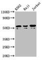 Western Blot; Positive WB detected in: K562 whole cell lysate, Raji whole cell lysate, Jurkat whole cell lysate; All lanes: TOX2 antibody at 4.3µg/ml; Secondary; Goat polyclonal to rabbit IgG at 1/50000 dilution; Predicted band size: 52, 55, 50, 54 kDa; Observed band size: 52, 50 kDa