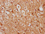 IHC image of CAC11548 diluted at 1:300 and staining in paraffin-embedded human brain tissue performed on a Leica BondTM system. After dewaxing and hydration, antigen retrieval was mediated by high pressure in a citrate buffer (pH 6.0). Section was blocked with 10% normal goat serum 30min at RT. Then primary antibody (1% BSA) was incubated at 4°C overnight. The primary is detected by a biotinylated secondary antibody and visualized using an HRP conjugated SP system.