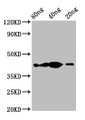 Western Blot; Positive WB detected in Recombinant protein; All lanes: th antibody at 2.3µg/ml; Secondary; Goat polyclonal to rabbit IgG at 1/50000 dilution; Predicted band size: 43 kDa; Observed band size: 43 kDa