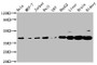 Western Blot; Positive WB detected in: Hela whole cell lysate, MCF-7 whole cell lysate, Jurkat whole cell lysate, Raji whole cell lysate, U87 whole cell lysate, HepG2 whole cell lysate, Rat liver tissue, Mouse brain tissue, Mouse kidney tissue; All lanes: PNCK antibody at 3.1µg/ml; Secondary; Goat polyclonal to rabbit IgG at 1/50000 dilution; Predicted band size: 39, 41, 28, 47 kDa; Observed band size: 39 kDa