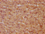 IHC image diluted at 1:300 and staining in paraffin-embedded human adrenal gland tissue performed on a Leica BondTM system. After dewaxing and hydration, antigen retrieval was mediated by high pressure in a citrate buffer (pH 6.0). Section was blocked with 10% normal goat serum 30min at RT. Then primary antibody (1% BSA) was incubated at 4°C overnight. The primary is detected by a biotinylated secondary antibody and visualized using an HRP conjugated SP system.