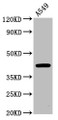 Western Blot; Positive WB detected in: A549 whole cell lysate; All lanes: CHST14 antibody at 4.8µg/ml; Secondary; Goat polyclonal to rabbit IgG at 1/50000 dilution; Predicted band size: 43 kDa; Observed band size: 43 kDa