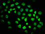 Immunofluorescence staining of A549 cells with CAC11567 at 1:116, counter-stained with DAPI. The cells were fixed in 4% formaldehyde, permeabilized using 0.2% Triton X-100 and blocked in 10% normal Goat Serum. The cells were then incubated with the antibody overnight at 4°C. The secondary antibody was Alexa Fluor 488-congugated AffiniPure Goat Anti-Rabbit IgG(H+L).