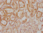 IHC image diluted at 1:300 and staining in paraffin-embedded human kidney tissue performed on a Leica BondTM system. After dewaxing and hydration, antigen retrieval was mediated by high pressure in a citrate buffer (pH 6.0). Section was blocked with 10% normal goat serum 30min at RT. Then primary antibody (1% BSA) was incubated at 4°C overnight. The primary is detected by a biotinylated secondary antibody and visualized using an HRP conjugated SP system.