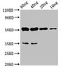 Western Blot; Positive WB detected in Recombinant protein; All lanes: cyp26b1 antibody at 4.4µg/ml; Secondary; Goat polyclonal to rabbit IgG at 1/50000 dilution; Predicted band size: 46 kDa; Observed band size: 51 kDa