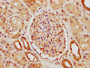 IHC image diluted at 1:500 and staining in paraffin-embedded human kidney tissue performed on a Leica BondTM system. After dewaxing and hydration, antigen retrieval was mediated by high pressure in a citrate buffer(pH 6.0). Section was blocked with 10% normal goat serum 30min at RT. Then primary antibody(1% BSA) was incubated at 4°C overnight. The primary is detected by a biotinylated secondary antibody and visualized using an HRP conjugated SP system.