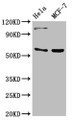 Western Blot; Positive WB detected in: Hela whole cell lysate, MCF-7 whole cell lysate; All lanes: RUNX2 antibody at 3µg/ml; Secondary; Goat polyclonal to rabbit IgG at 1/50000 dilution; Predicted band size: 57, 56, 55 kDa; Observed band size: 57 kDa;