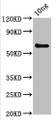 Western Blot; Positive WB detected in Recombinant protein; All lanes: pepP antibody at 3.8µg/ml; Secondary; Goat polyclonal to rabbit IgG at 1/50000 dilution; Predicted band size: 58 kDa; Observed band size: 58 kDa;