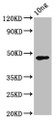 Western Blot; Positive WB detected in Recombinant protein; All lanes: pmpD antibody at 3.9µg/ml; Secondary; Goat polyclonal to rabbit IgG at 1/50000 dilution; Predicted band size: 47 kDa; Observed band size: 47 kDa;
