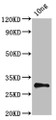 Western Blot; Positive WB detected in Recombinant protein; All lanes: NS antibody at 5µg/ml; Secondary; Goat polyclonal to rabbit IgG at 1/50000 dilution; Predicted band size: 32 kDa; Observed band size: 32 kDa