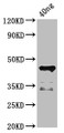Western Blot; Positive WB detected in Recombinant protein; All lanes: ligA antibody at 4.5µg/ml; Secondary; Goat polyclonal to rabbit IgG at 1/50000 dilution; Predicted band size: 45 kDa; Observed band size: 45 kDa;