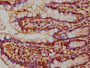 IHC image diluted at 1:200 and staining in paraffin-embedded human small intestine tissue performed on a Leica BondTM system. After dewaxing and hydration, antigen retrieval was mediated by high pressure in a citrate buffer (pH 6.0). Section was blocked with 10% normal goat serum 30min at RT. Then primary antibody (1% BSA) was incubated at 4°C overnight. The primary is detected by a biotinylated secondary antibody and visualized using an HRP conjugated SP system.