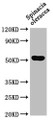 Western Blot; Positive WB detected in: Spinacia oleracea leaf tissue; All lanes: SUN1 antibody at 1:1000; Secondary; Goat polyclonal to rabbit IgG at 1/50000 dilution; Predicted band size: 52 kDa; Observed band size: 52 kDa