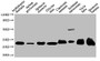 Western Blot; Positive WB detected in: Arabidopsis thaliana leaf tissue, Apium graveolens leaf tissue, Spinacia oleracea leaf tissue, Glycine max leaf tissue, Capsicum annuum leaf tissue, Solanum tuberosum leaf tissue, Vicia faba leaf tissue, Ipomoea batatas leaf tissue; All lanes: VDAC1 antibody at 1:1000; Secondary; Goat polyclonal to rabbit IgG at 1/50000 dilution; Predicted band size: 30 kDa; Observed band size: 30 kDa