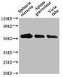 Western Blot; Positive WB detected in: Spinacia oleracea leaf tissue, Apium graveolens leaf tissue, Vicia faba leaf tissue; All lanes: PEX14 antibody at 1:1000; Secondary; Goat polyclonal to rabbit IgG at 1/50000 dilution; Predicted band size: 56 kDa; Observed band size: 56 kDa