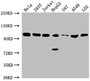 Western Blot; Positive WB detected in: Hela whole cell lysate, 293T whole cell lysate, Jurkat whole cell lysate, HepG2 whole cell lysate, U87 whole cell lysate, A549 whole cell lysate, LO2 whole cell lysate; All lanes: ADAR antibody at 1:2000; Secondary; Goat polyclonal to rabbit IgG at 1/50000 dilution; Predicted band size: 137, 134, 132, 141, 104 kDa; Observed band size: 104 kDa;