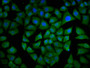 Immunofluorescence staining of Hela cells with CAC11657 at 1:133, counter-stained with DAPI. The cells were fixed in 4% formaldehyde, permeabilized using 0.2% Triton X-100 and blocked in 10% normal Goat Serum. The cells were then incubated with the antibody overnight at 4°C. The secondary antibody was Alexa Fluor 488-congugated AffiniPure Goat Anti-Rabbit IgG(H+L).