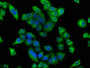 Immunofluorescence staining of Hela cells with CAC11660 at 1:100, counter-stained with DAPI. The cells were fixed in 4% formaldehyde, permeabilized using 0.2% Triton X-100 and blocked in 10% normal Goat Serum. The cells were then incubated with the antibody overnight at 4°C. The secondary antibody was Alexa Fluor 488-congugated AffiniPure Goat Anti-Rabbit IgG(H+L).