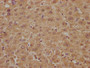 IHC image diluted at 1:300 and staining in paraffin-embedded human liver tissue performed on a Leica BondTM system. After dewaxing and hydration, antigen retrieval was mediated by high pressure in a citrate buffer (pH 6.0). Section was blocked with 10% normal goat serum 30min at RT. Then primary antibody (1% BSA) was incubated at 4°C overnight. The primary is detected by a biotinylated secondary antibody and visualized using an HRP conjugated SP system.