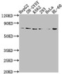 Western Blot; Positive WB detected in: HepG2 whole cell lysate, SH-SY5Y whole cell lysate, K562 whole cell lysate, 293 whole cell lysate, Hela whole cell lysate, HL60 whole cell lysate; All lanes: VASN antibody at 1:2000; Secondary; Goat polyclonal to rabbit IgG at 1/50000 dilution; Predicted band size: 72 kDa; Observed band size: 72 kDa