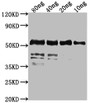 Western Blot; Positive WB detected in Recombinant protein; All lanes: fkpA antibody at 1:2000; Secondary; Goat polyclonal to rabbit IgG at 1/50000 dilution; Predicted band size: 55 kDa; Observed band size: 55 kDa;