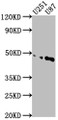 Western Blot; Positive WB detected in: U251 whole cell lysate, U87 whole cell lysate; All lanes: OTUD3 antibody at 1:1000; Secondary; Goat polyclonal to rabbit IgG at 1/50000 dilution; Predicted band size: 46 kDa; Observed band size: 46 kDa;