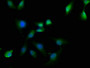 Immunofluorescence staining of U251 cells with CAC11672 at 1:50, counter-stained with DAPI. The cells were fixed in 4% formaldehyde, permeabilized using 0.2% Triton X-100 and blocked in 10% normal Goat Serum. The cells were then incubated with the antibody overnight at 4°C. The secondary antibody was Alexa Fluor 488-congugated AffiniPure Goat Anti-Rabbit IgG(H+L).