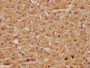 IHC image of CAC11673 diluted at 1:100 and staining in paraffin-embedded human liver tissue performed on a Leica BondTM system. After dewaxing and hydration, antigen retrieval was mediated by high pressure in a citrate buffer (pH 6.0). Section was blocked with 10% normal goat serum 30min at RT. Then primary antibody (1% BSA) was incubated at 4°C overnight. The primary is detected by a biotinylated secondary antibody and visualized using an HRP conjugated SP system.