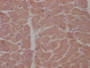 IHC image diluted at 1:100 and staining in paraffin-embedded human heart tissue performed on a Leica BondTM system. After dewaxing and hydration, antigen retrieval was mediated by high pressure in a citrate buffer (pH 6.0). Section was blocked with 10% normal goat serum 30min at RT. Then primary antibody (1% BSA) was incubated at 4°C overnight. The primary is detected by a biotinylated secondary antibody and visualized using an HRP conjugated SP system.