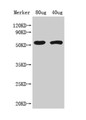 Western Blot; Positive WB detected in Recombinant protein; All lanes: ACS8 antibody at 1:1000; Secondary; Goat polyclonal to rabbit IgG at 1/50000 dilution; Predicted band size: 59 kDa; Observed band size: 59 kDa;