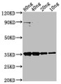 Western Blot; Positive WB detected in Recombinant protein; All lanes: M antibody at 1:2000; Secondary; Goat polyclonal to rabbit IgG at 1/50000 dilution; Predicted band size: 35 kDa; Observed band size: 35 kDa;