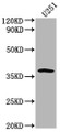 Western Blot; Positive WB detected in: U251 whole cell lysate; All lanes: OR6B3 antibody at 1:2000; Secondary; Goat polyclonal to rabbit IgG at 1/50000 dilution; Predicted band size: 38 kDa; Observed band size: 38 kDa;
