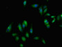 Immunofluorescent analysis of Hela cells using CAC11723 at dilution of 1:100 and Alexa Fluor 488-congugated AffiniPure Goat Anti-Rabbit IgG(H+L)