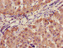 Immunohistochemistry of paraffin-embedded human liver tissue using CAC11725 at dilution of 1:100