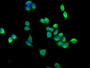 Immunofluorescence staining of PC-3 cells with CAC11726 at 1:166,counter-stained with DAPI. The cells were fixed in 4% formaldehyde, permeabilized using 0.2% Triton X-100 and blocked in 10% normal Goat Serum. The cells were then incubated with the antibody overnight at 4°C.The secondary antibody was Alexa Fluor 488-congugated AffiniPure Goat Anti-Rabbit IgG (H+L).