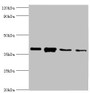 Western blot; All lanes: Anxa1 antibody at 2µg/ml; Lane 1: PC-3 whole cell lysate; Lane 2: A431 whole cell lysate; Lane 3: K562 whole cell lysate; Lane 4: MCF-7 whole cell lysate; Secondary; Goat polyclonal to rabbit IgG at 1/10000 dilution; Predicted band size: 39 kDa; Observed band size: 39 kDa