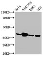 Western Blot; ,Positive WB detected in: Hela whole cell lysate, NIH/3T3 whole cell lysate, K562 whole cell lysate, PC-3 whole cell lysate; ,All lanes: Anxa1 antibody at 2.9µg/ml; ,Secondary; ,Goat polyclonal to rabbit IgG at 1/50000 dilution; ,Predicted band size: 39 kDa; ,Observed band size: 39 kDa