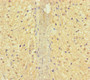 Immunohistochemistry of paraffin-embedded human adrenal gland tissue using CAC11745 at dilution of 1:100