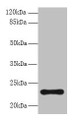 Western blot; All lanes: AP3S2 antibody at 6µg/ml + A549 whole cell lysate; Secondary; Goat polyclonal to rabbit IgG at 1/10000 dilution; Predicted band size: 23, 44, 15 kDa; Observed band size: 23 kDa