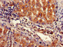 Immunohistochemistry of paraffin-embedded human liver cancer using CAC11750 at dilution of 1:100