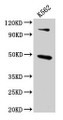 Western Blot; Positive WB detected in: K562 whole cell lysate; All lanes: ARRB1 antibody at 4.6µg/ml; Secondary; Goat polyclonal to rabbit IgG at 1/50000 dilution; Predicted band size: 48, 47 kDa; Observed band size: 48 kDa