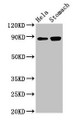 Western Blot; Positive WB detected in: Hela whole cell lysate, Rat stomach tissue; All lanes: ASAH2 antibody at 3µg/ml; Secondary; Goat polyclonal to rabbit IgG at 1/50000 dilution; Predicted band size: 86, 82 kDa; Observed band size: 86 kDa