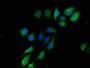 Immunofluorescence staining of A549 cells with CAC11760 at 1:133, counter-stained with DAPI. The cells were fixed in 4% formaldehyde, permeabilized using 0.2% Triton X-100 and blocked in 10% normal Goat Serum. The cells were then incubated with the antibody overnight at 4°C. The secondary antibody was Alexa Fluor 488-congugated AffiniPure Goat Anti-Rabbit IgG(H+L).