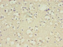 Immunohistochemistry of paraffin-embedded human brain tissue using CAC11761 at dilution of 1:100