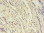 Immunohistochemistry of paraffin-embedded human lung tissue using CAC11762 at dilution of 1:100