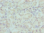 Immunohistochemistry of paraffin-embedded human gastric cancer using CAC11773 at dilution of 1:100