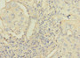 Immunohistochemistry of paraffin-embedded human lung cancer using CAC11774 at dilution of 1:100