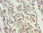 Immunohistochemistry of paraffin-embedded human lung tissue using CAC11779 at dilution of 1:100