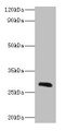 Western blot; All lanes: Ca1 antibody at 2µg/ml + Rat spleen tissue; Secondary; Goat polyclonal to rabbit IgG at 1/10000 dilution; Predicted band size: 29 kDa; Observed band size: 29 kDa
